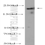 ABCA7 Antibody - ATP-binding cassette, sub-family A (ABC1), member 7