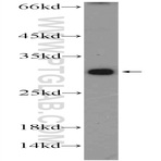 C19orf36 Antibody - chromosome 19 open reading frame 36