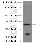 C10orf58 Antibody - chromosome 10 open reading frame 58