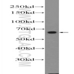 FZD5 Antibody - frizzled homolog 5 (Drosophila)
