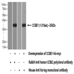 CCBE1 Antibody - collagen and calcium binding EGF domains 1