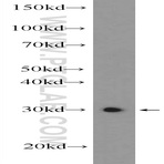 ZCRB1 Antibody - zinc finger CCHC-type and RNA binding motif 1