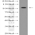 DENND1A Antibody - DENN/MADD domain containing 1A
