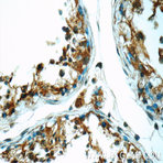 ODF1 Antibody - outer dense fiber of sperm tails 1