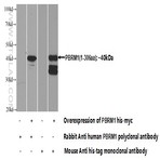PBRM1 Antibody - polybromo 1