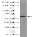 ZNF846 Antibody - zinc finger protein 846
