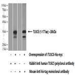 TUSC5 Antibody - tumor suppressor candidate 5