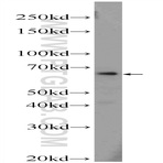 ZNF774 Antibody - zinc finger protein 774