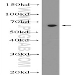 ZNF654 Antibody - zinc finger protein 654
