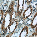 VIPR1 Antibody - vasoactive intestinal peptide receptor 1
