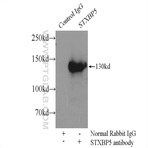 STXBP5 Antibody - syntaxin binding protein 5 (tomosyn)