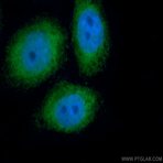 PIWIL1 Antibody - piwi-like 1 (Drosophila)