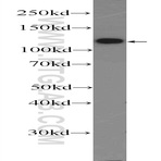 NCX1 Antibody - solute carrier family 8 (sodium/calcium exchanger), member 1