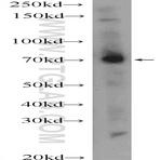 MPZL3 Antibody - myelin protein zero-like 3