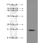 SNRPD3 Antibody - small nuclear ribonucleoprotein D3 polypeptide 18kDa