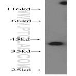 MAPRE2 Antibody - microtubule-associated protein, RP/EB family, member 2