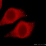 DAB2 Antibody - disabled homolog 2, mitogen-responsive phosphoprotein (Drosophila)