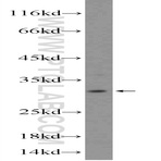 TIP30 Antibody - HIV-1 Tat interactive protein 2, 30kDa