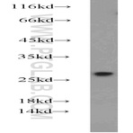 GRB2 Antibody - growth factor receptor-bound protein 2