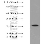 CBX1 Antibody - chromobox homolog 1 (HP1 beta homolog Drosophila )