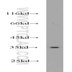GNB3 Antibody - guanine nucleotide binding protein (G protein), beta polypeptide 3