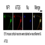 ATG5 Antibody - ATG5 autophagy related 5 homolog (S. cerevisiae)