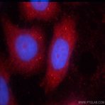 STAT3 Antibody - signal transducer and activator of transcription 3 (acute-phase response factor)