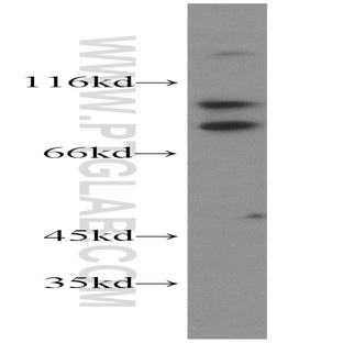 KIFC3 Antibody - kinesin family member C3