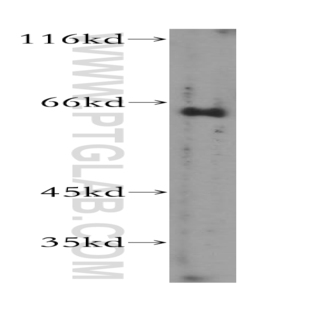 GTF2H1 Antibody - general transcription factor IIH, polypeptide 1, 62kDa