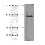 GTF2H1 Antibody - general transcription factor IIH, polypeptide 1, 62kDa