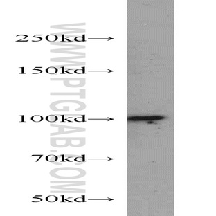 DDX23 Antibody - DEAD (Asp-Glu-Ala-Asp) box polypeptide 23