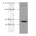RABEPK Antibody - Rab9 effector protein with kelch motifs