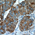 TUSC4 Antibody - tumor suppressor candidate 4