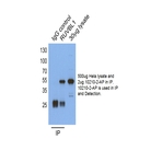 RUVBL1 Antibody - RuvB-like 1 (E. coli)