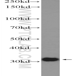 SNRPA Antibody - small nuclear ribonucleoprotein polypeptide A