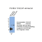 PRKAR2A Antibody - protein kinase, cAMP-dependent, regulatory, type II, alpha