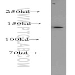 DHX38 Antibody - DEAH (Asp-Glu-Ala-His) box polypeptide 38