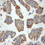 Cytokeratin 15 Antibody - keratin 15
