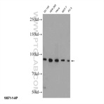 ELAC2 Antibody - elaC homolog 2 (E. coli)