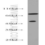 GTF2F1 Antibody - general transcription factor IIF, polypeptide 1, 74kDa