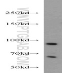 PRPF3 Antibody - PRP3 pre-mRNA processing factor 3 homolog (S. cerevisiae)