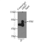 GRB7 Antibody - growth factor receptor-bound protein 7