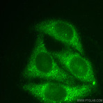SNAPIN Antibody - SNAP-associated protein