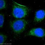 MEF2C Antibody - myocyte enhancer factor 2C