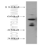 GRB10 Antibody - growth factor receptor-bound protein 10