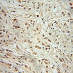 RB1 Antibody - retinoblastoma 1