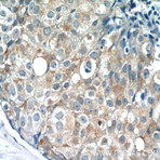 PACSIN2 Antibody - protein kinase C and casein kinase substrate in neurons 2