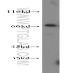 BCRP/ABCG2 Antibody - ATP-binding cassette, sub-family G (WHITE), member 2