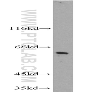 SLC47A1 Antibody - solute carrier family 47, member 1
