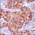 MSH2 Antibody - mutS homolog 2, colon cancer, nonpolyposis type 1 (E. coli)